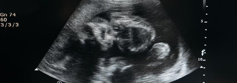 When Do You Get Your First Ultrasound Picture? guide cover image