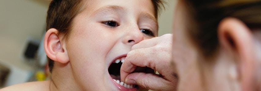How to Pull Out a Child's Tooth guide cover image